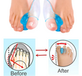 Silikon Gel Zehenspreizer für Hallux Valgus – 2 Stück, Wiederverwendbar, Komfortabel 6